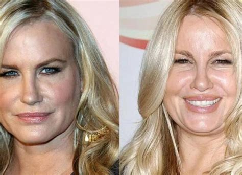 jennifer coolidge plastic surgery